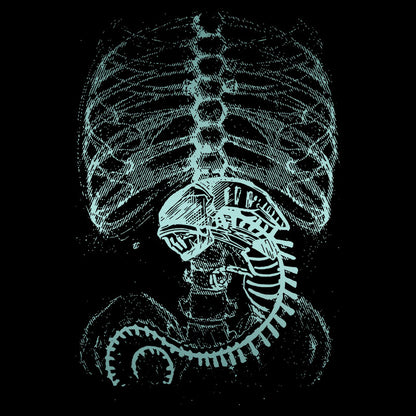 Alien Radiography X-Ray Classic T-Shirt